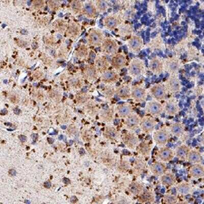 Immunohistochemistry-Paraffin: Niemann-Pick C1 Antibody (1318A) - Azide and BSA Free [NBP2-80879] - Niemann-Pick Type C1/NPC1 was detected in immersion fixed paraffin-embedded sections of human brain (cerebellum) using Rabbit Anti-Human/Mouse/Rat Niemann-Pick Type C1/NPC1 Monoclonal Antibody (NBP2-76798) at 3 ug/mL for 1 hour at room temperature followe