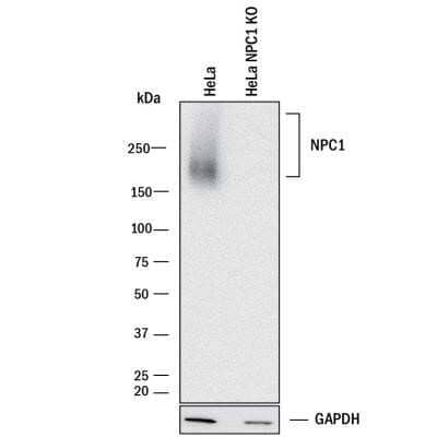 Knockout Validated: Niemann-Pick C1 Antibody (1318A) - Azide and BSA Free [NBP2-80879] - Western blot shows lysates of HeLa human cervical epithelial carcinoma parental cell line and Niemann-Pick Type C1/NPC1 knockout HeLa cell line (KO). PVDF membrane was probed with 0.5 ug/mL of Rabbit Anti-Human/Mouse/Rat Niemann-Pick Type C1/NPC1 Monoclonal Antibody (Catalog # MAB10105) followed by HRP-conjugated Anti-Rabbit IgG Secondary Antibody (Catalog # HAF008). A specific band was detected for Niemann-Pick Type C1/NPC1 at approximately 170-250 kDa (as indicated) in the parental HeLa cell line, but is not detectable in knockout HeLa cell line. GAPDH (Catalog # MAB5718) is shown as a loading control. This experiment was conducted under reducing conditions. Image from the standard format of this antibody.