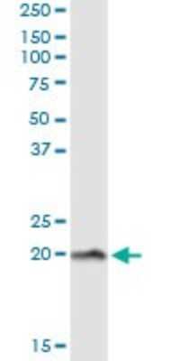 Immunoprecipitation: Niemann-Pick type C2 Antibody (1F4) [H00010577-M11] - Analysis of NPC2 transfected lysate using anti-NPC2 monoclonal antibody and Protein A Magnetic Bead, and immunoblotted with NPC2 rabbit polyclonal antibody.