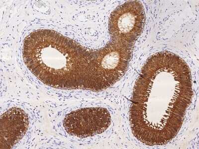 Immunohistochemistry-Paraffin: Niemann-Pick type C2 Antibody [NBP2-99920] - Immunochemical staining of human Niemann-Pick type C2 in human epididymis with rabbit polyclonal antibody (1:20000, formalin-fixed paraffin embedded sections).