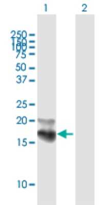 Western Blot: Niemann-Pick type C2 Antibody [H00010577-B01P] - Analysis of NPC2 expression in transfected 293T cell line by NPC2 polyclonal antibody.  Lane 1: NPC2 transfected lysate(16.61 KDa). Lane 2: Non-transfected lysate.