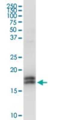 Western Blot: Niemann-Pick type C2 Antibody [H00010577-D01P] - Analysis of NPC2 expression in PC-12.