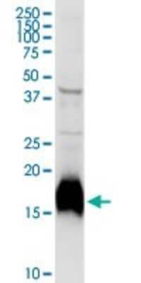Western Blot: Niemann-Pick type C2 Antibody [H00010577-D01P] - Analysis of NPC2 expression in human kidney.