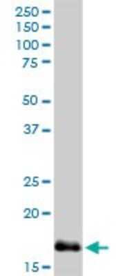 Western Blot: Niemann-Pick type C2 Antibody [H00010577-D01P] - Analysis of NPC2 expression in mouse lung.