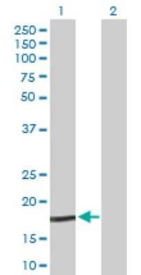 Western Blot: Niemann-Pick type C2 Antibody [H00010577-D01P] - Analysis of NPC2 expression in transfected 293T cell line by NPC2 polyclonal antibody.Lane 1: NPC2 transfected lysate(16.60 KDa).Lane 2: Non-transfected lysate.