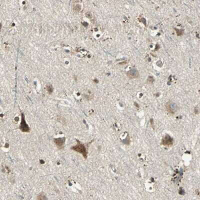 Immunohistochemistry-Paraffin: Nitrilase 1 Antibody [NBP1-87481] - Staining of human cerebral cortex shows strong cytoplasmic positivity in neuronal cells and glial cells.