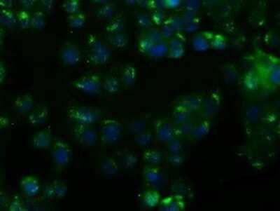 Immunocytochemistry/Immunofluorescence: Nitrilase 1 Antibody (OTI3A11) - Azide and BSA Free [NBP2-72999] - Staining of HT29 cells using anti-Nitrilase 1 mouse monoclonal antibody.
