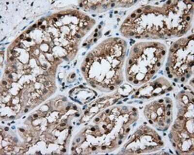 Immunohistochemistry: Nitrilase 1 Antibody (OTI3A11) - Azide and BSA Free [NBP2-72999] - Staining of paraffin-embedded Kidney tissue using anti-Nitrilase 1 mouse monoclonal antibody.