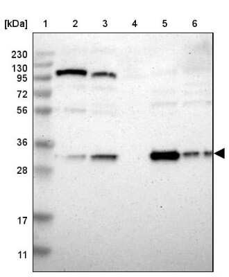 Western Blot: Nitrilase 1 Antibody [NBP1-87481] - Lane 1: Marker  [kDa] 230, 130, 95, 72, 56, 36, 28, 17, 11.  Lane 2: Human cell line RT-4.  Lane 3: Human cell line U-251MG sp.  Lane 4: Human plasma (IgG/HSA depleted).  Lane 5: Human liver tissue.  Lane 6: Human tonsil tissue