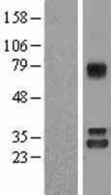 Western Blot: Nitrilase 1 Overexpression Lysate (Adult Normal) [NBL1-13648] Left-Empty vector transfected control cell lysate (HEK293 cell lysate); Right -Over-expression Lysate for Nitrilase 1.
