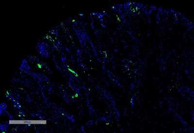 Immunohistochemistry: Nitrotryptophan Antibody (4F8) [NBP2-59355] - Immunohistochemistry analysis using Mouse Anti-Nitrotryptophan Monoclonal Antibody, Clone 4F8 (NBP2-59355). Tissue: Thyroid Cancer. Species: Human. Primary Antibody: Mouse Anti-Nitrotryptophan Monoclonal Antibody (NBP2-59355) at 1:100 for Overnight at 4C, then 30 min at 37C. Secondary Antibody: Goat Anti-Mouse IgG (H+L): FITC for 45 min at 37C. Counterstain: DAPI for 3 min at RT. Magnification: 5X.