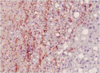 Immunohistochemistry-Paraffin: Nitrotyrosine Antibody (HM11) [Biotin] [NB110-2023] - Nitrotyrosine in human liver of severely obesed patients. Staining of paraffin tissue section with clone   HM.11. Anti-nitrotyrosine at 2 ug/ml (1h, RT).