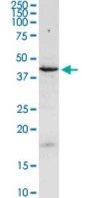 Western Blot: Njmu-R1 Antibody [H00064149-D01P] - Analysis of C17orf75 expression in MCF-7.