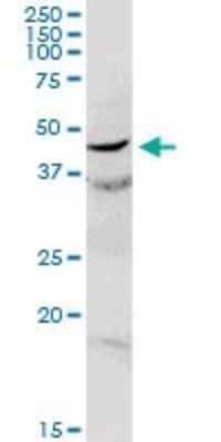 Western Blot: Njmu-R1 Antibody [H00064149-D01P] - Analysis of C17orf75 expression in human liver.