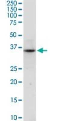 Western Blot: Njmu-R1 Antibody [H00064149-D01P] - Analysis of C17orf75 expression in mouse liver.