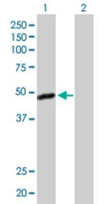 Western Blot: Njmu-R1 Antibody [H00064149-D01P] - Analysis of C17orf75 expression in transfected 293T cell line by C17orf75 polyclonal antibody.Lane 1: C17orf75 transfected lysate(44.60 KDa).Lane 2: Non-transfected lysate.