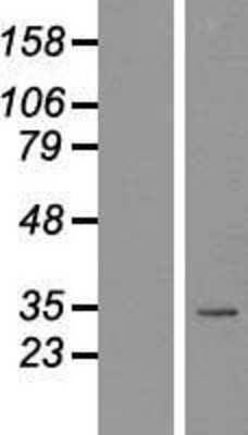 Western Blot: Nkx2.2 Overexpression Lysate (Adult Normal) [NBL1-13661] Left-Empty vector transfected control cell lysate (HEK293 cell lysate); Right -Over-expression Lysate for Nkx2.2.