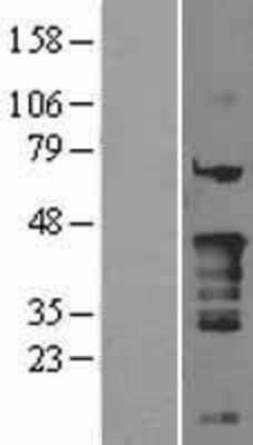 Western Blot: Nkx2.5 Overexpression Lysate (Adult Normal) [NBL1-13659] Left-Empty vector transfected control cell lysate (HEK293 cell lysate); Right -Over-expression Lysate for Nkx2.5.