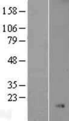 Western Blot: Nkx3.1 Overexpression Lysate (Adult Normal) [NBL1-13662] Left-Empty vector transfected control cell lysate (HEK293 cell lysate); Right -Over-expression Lysate for Nkx3.1.