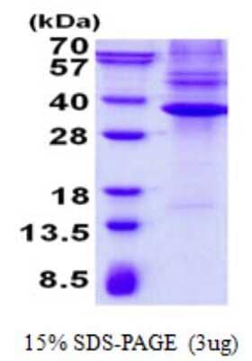 SDS-Page: Nkx3.1 Protein [NBP2-23290]