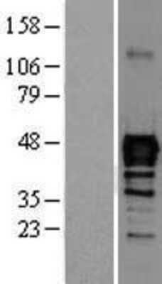 Western Blot: Nkx6.1 Overexpression Lysate (Adult Normal) [NBL1-13663] Left-Empty vector transfected control cell lysate (HEK293 cell lysate); Right -Over-expression Lysate for Nkx6.1.