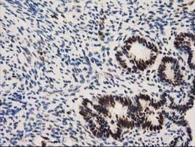 Immunohistochemistry-Paraffin: Nmnat1 Antibody (1G4) [NBP2-03452] - Staining of paraffin-embedded Human endometrium tissue using anti-Nmnat1 mouse monoclonal antibody.