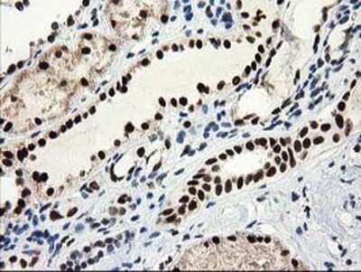 Immunohistochemistry-Paraffin: Nmnat1 Antibody (1G4) [NBP2-03452] - Staining of paraffin-embedded Human Kidney tissue using anti-Nmnat1 mouse monoclonal antibody.