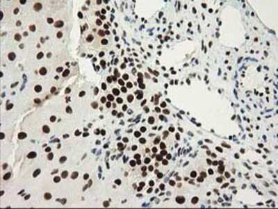 Immunohistochemistry-Paraffin: Nmnat1 Antibody (1G4) [NBP2-03452] - Staining of paraffin-embedded Human Ovary tissue using anti-Nmnat1 mouse monoclonal antibody.