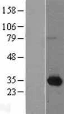 Western Blot: Nmnat1 Overexpression Lysate (Adult Normal) [NBL1-13691] Left-Empty vector transfected control cell lysate (HEK293 cell lysate); Right -Over-expression Lysate for Nmnat1.