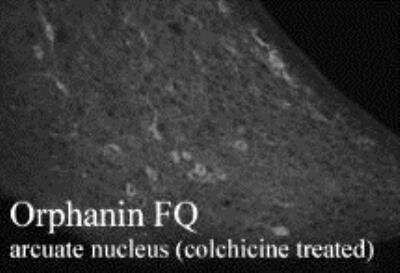 Immunohistochemistry: Nociceptin Antibody [NB100-1619] - This orphanin FQ robustly stains nerve fibers in brain and spinal cord. Animals were treated with colchicines to visualize orphanin FQ-expressing cell bodies. Staining was blocked by preabsorption with the cognate peptide.