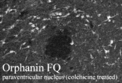 Immunohistochemistry: Nociceptin Antibody [NB100-1659] - Immunohistochemistry: This orphanin FQ robustly stains nerve fibers in brain and spinal cord. Animals were treated with colchicines to visualize orphanin FQ-expressing cell bodies. Staining was blocked by preabsorption with the cognate peptide.