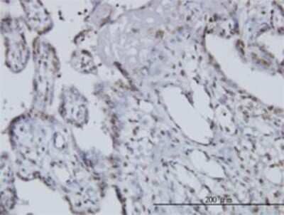 Immunohistochemistry-Paraffin: Nocturnin Antibody (3E8) [H00025819-M01] - Analysis of monoclonal antibody to CCRN4L on formalin-fixed paraffin-embedded human placenta. Antibody concentration 3 ug/ml.