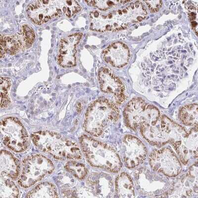 Immunohistochemistry: Nocturnin Antibody [NBP2-37939] - Staining of human kidney shows strong cytoplasmic positivity in renal tubules.