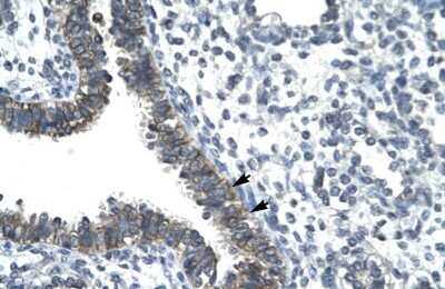 Immunohistochemistry: Nocturnin Antibody [NBP2-87931] - Human Lung