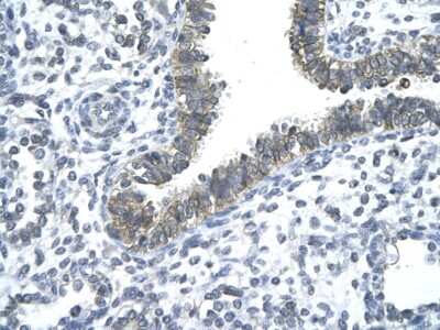 Immunohistochemistry-Paraffin: Nocturnin Antibody [NBP2-87931] - Rabbit Anti-CCRN4L antibody. Paraffin Embedded Tissue: Human Lung cell Cellular Data: bronchiole epithelium of renal tubule. Antibody Concentration: 4.0-8.0 ug/ml. Magnification: 400X