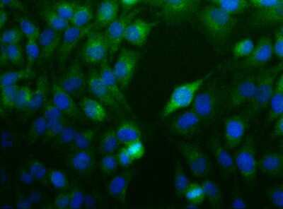 Immunocytochemistry/Immunofluorescence: Nodal Antibody [NBP1-71686] - ICC staining of NODAL in HeLa cells.