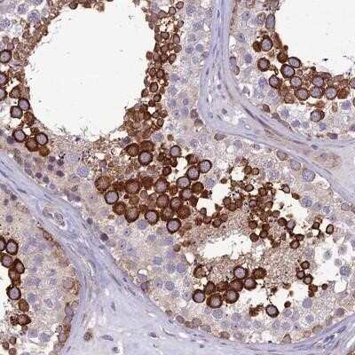 Immunohistochemistry-Paraffin: Nodal Antibody [NBP2-13664] - Staining of human testis shows strong cytoplasmic positivity in cells in seminiferus ducts.