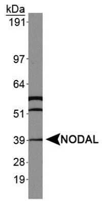 Western Blot: Nodal Antibody [NBP1-71686] - Analysis of NODAL in HeLa whole cell extracts.