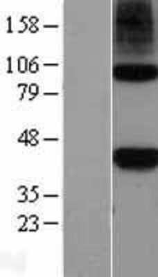 Western Blot: Nodal Overexpression Lysate (Adult Normal) [NBL1-13706] Left-Empty vector transfected control cell lysate (HEK293 cell lysate); Right -Over-expression Lysate for Nodal.