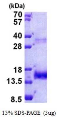 SDS-Page: Recombinant Human Olfactomedin-1/Noelin-1 Protein [NBP2-23306]