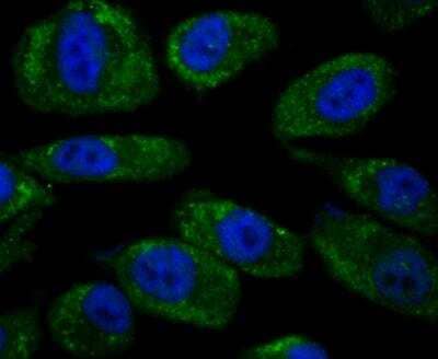 Immunocytochemistry/Immunofluorescence: Noggin Antibody [NBP3-09068] - ICC staining Noggin in PC-3M cells (green). The nuclear counter stain is DAPI (blue). Cells were fixed in paraformaldehyde, permeabilised with 0.25% Triton X100/PBS.
