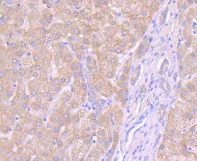 Immunohistochemistry-Paraffin: Noggin Antibody [NBP3-09068] - Immunohistochemical analysis of paraffin-embedded human liver tissue using anti-Noggin antibody. Counter stained with hematoxylin.