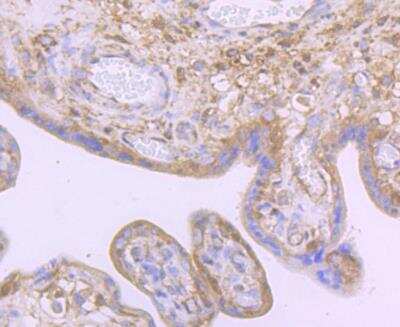 Immunohistochemistry-Paraffin: Noggin Antibody [NBP3-09068] - Immunohistochemical analysis of paraffin-embedded human placenta tissue using anti-Noggin antibody. Counter stained with hematoxylin.