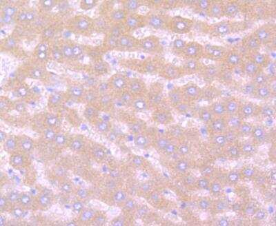 Immunohistochemistry-Paraffin: Noggin Antibody [NBP3-09068] - Immunohistochemical analysis of paraffin-embedded rat liver tissue using anti-Noggin antibody. Counter stained with hematoxylin.