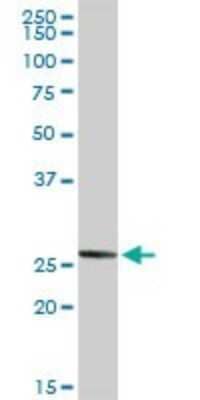 Western Blot: Noggin Antibody [H00009241-D01P] - Analysis of NOG expression in human liver.