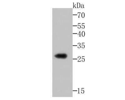 Western Blot: Noggin Antibody [NBP3-09068] - Western blot analysis of Noggin on Recombinant protein using anti-Noggin antibody at 1/500 dilution.