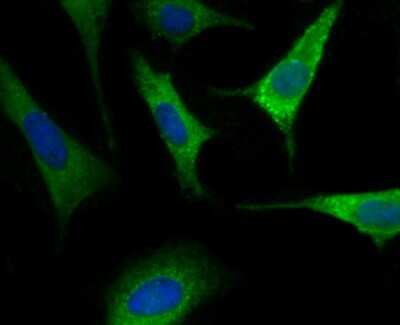 Immunocytochemistry/Immunofluorescence: Nogo Antibody (JM02-34) [NBP2-75595] - Staining Nogo in SH-SY5Y cells (green). The nuclear counter stain is DAPI (blue). Cells were fixed in paraformaldehyde, permeabilised with 0.25% Triton X100/PBS.