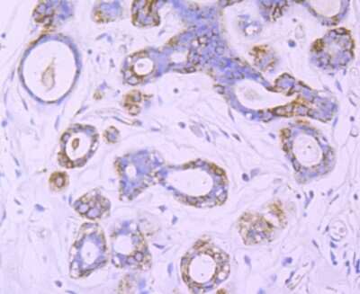 Immunohistochemistry-Paraffin: Nogo Antibody (JM02-34) [NBP2-75595] - Immunohistochemical analysis of paraffin-embedded human breast tissue using anti-Nogo antibody. The section was pre-treated using heat mediated antigen retrieval with Tris-EDTA buffer (pH 9.0) for 20 minutes.The tissues were blocked in 1% BSA for 30 minutes at room temperature, washed with ddH2O and PBS, and then probed with the primary antibody at 1:50 for 30 minutes at room temperature. The detection was performed using an HRP conjugated compact polymer system. DAB was used as the chromogen. Tissues were counterstained with hematoxylin and mounted with DPX.