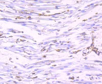 Immunohistochemistry-Paraffin: Nogo Antibody (JM02-34) [NBP2-75595] - Immunohistochemical analysis of paraffin-embedded human fetal skeletal muscle tissue using anti-Nogo antibody. The section was pre-treated using heat mediated antigen retrieval with Tris-EDTA buffer (pH 9.0) for 20 minutes.The tissues were blocked in 1% BSA for 30 minutes at room temperature, washed with ddH2O and PBS, and then probed with the primary antibody at 1:50 for 30 minutes at room temperature. The detection was performed using an HRP conjugated compact polymer system. DAB was used as the chromogen. Tissues were counterstained with hematoxylin and mounted with DPX.
