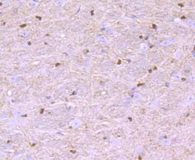 Immunohistochemistry-Paraffin: Nogo Antibody (JM02-34) [NBP2-75595] - Immunohistochemical analysis of paraffin-embedded mouse brain tissue using anti-Nogo antibody. The section was pre-treated using heat mediated antigen retrieval with Tris-EDTA buffer (pH 9.0) for 20 minutes.The tissues were blocked in 1% BSA for 30 minutes at room temperature, washed with ddH2O and PBS, and then probed with the primary antibody at 1:50 for 30 minutes at room temperature. The detection was performed using an HRP conjugated compact polymer system. DAB was used as the chromogen. Tissues were counterstained with hematoxylin and mounted with DPX.